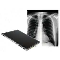 VAREX 14” x 17” WIRELESS