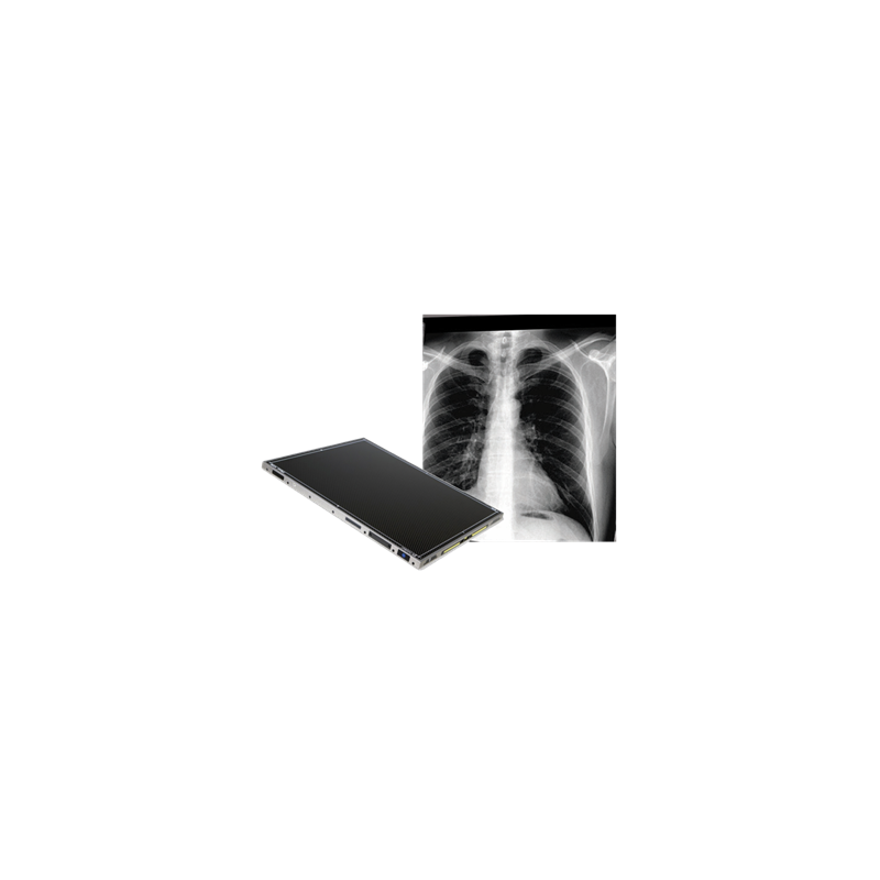 VAREX 14” x 17” WIRELESS
