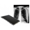 VAREX 14” x 17” WIRELESS